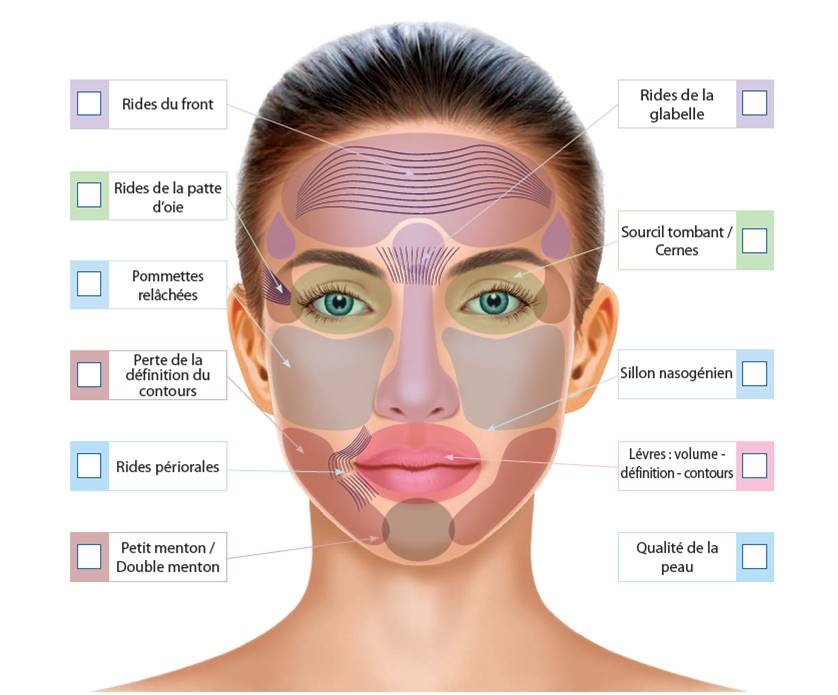 Médecine esthétique du visage - Zones